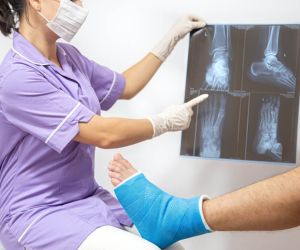 Orthopedic Trauma & Fracture Care
