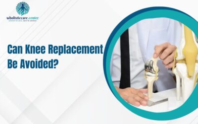 Can Knee Replacement Be Avoided?