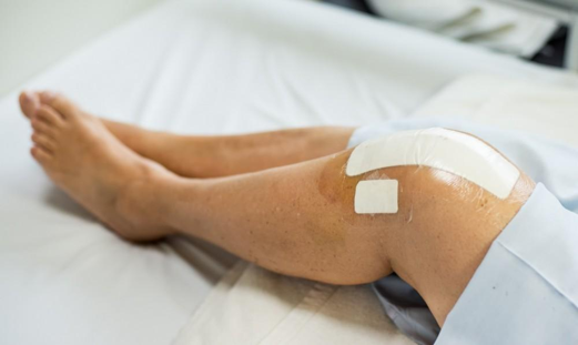 Knee Replacement for Diabetic Patients