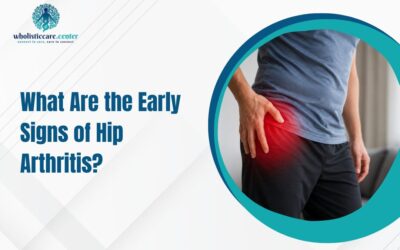 What Are the Early Signs of Hip Arthritis?